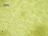Cellule corticali in visione superficiale